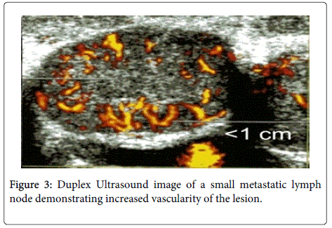 clinical-pathology-Duplex-Ultrasound