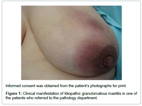 clinical-pathology-Idiopathic-pathology