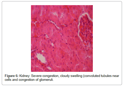 clinical-pathology-Kidney-cloudy