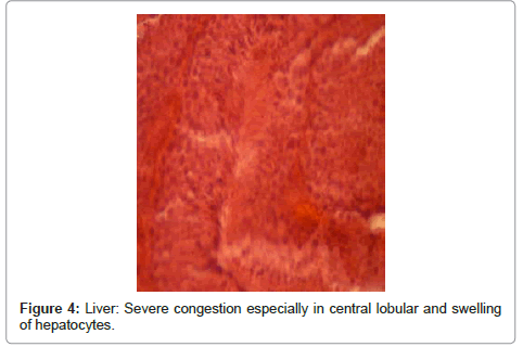 clinical-pathology-Liver-lobular