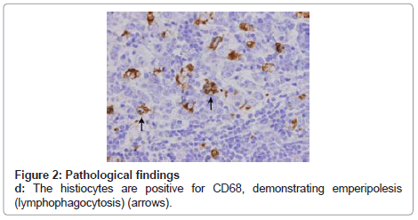 clinical-pathology-Pathological-findings
