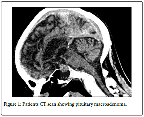 clinical-pathology-Patients-CT-scan
