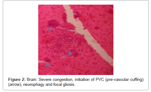 clinical-pathology-Severe-congestion