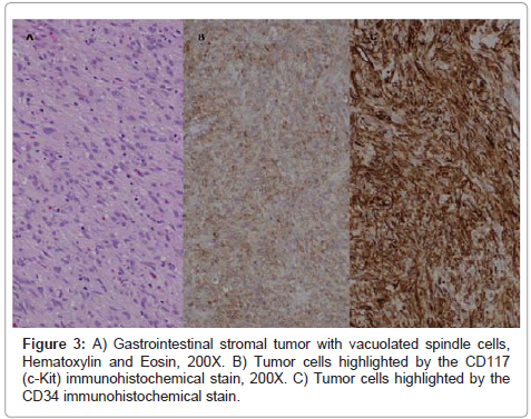 clinical-pathology-Tumor-cells