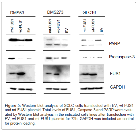 clinical-pathology-Western-blot