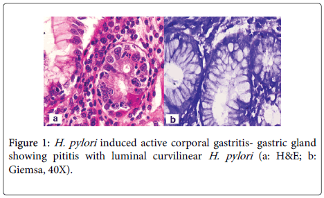 H Pylori Weight Loss Case Report Form