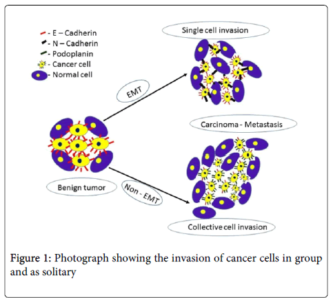 clinical-pathology-cancer-cells