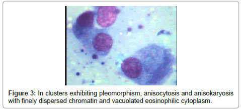 clinical-pathology-cytoplasm-anisokaryosis