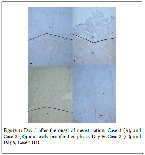 clinical-pathology-early-proliferative-phase