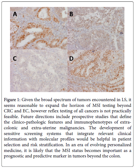 clinical-pathology-extra-uterine-malignancies