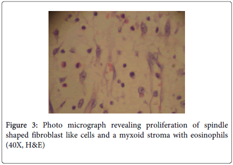 clinical-pathology-fibroblast-like-cells