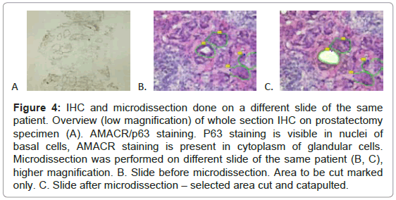 clinical-pathology-glandular-cells