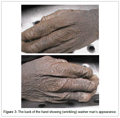 clinical-pathology-hand-showing