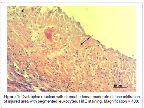 clinical-pathology-injured-area