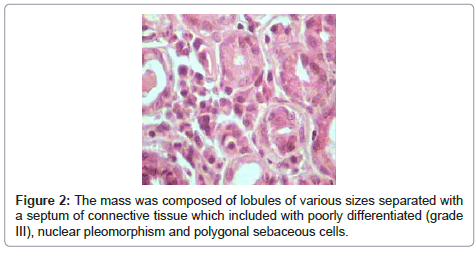clinical-pathology-lobules-sizes