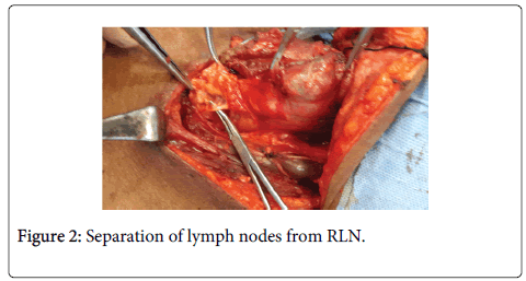 clinical-pathology-lymph-nodes