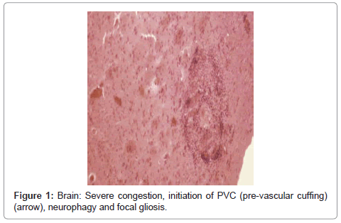 clinical-pathology-neurophagy-focal