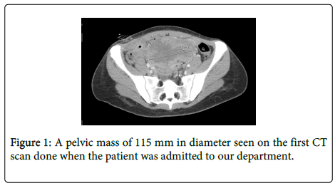 clinical-pathology-pelvic-mass