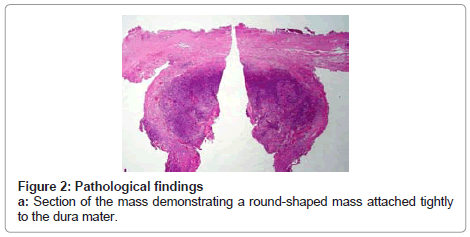 clinical-pathology-round-shaped-mass
