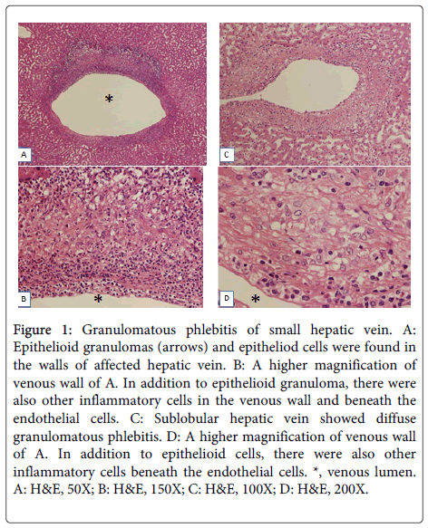 clinical-pathology-small-hepatic-vein