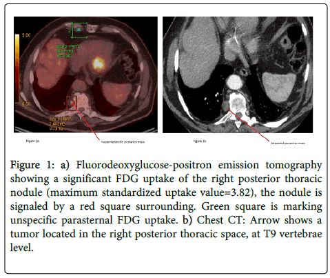 clinical-pathology-tomography-thoracic