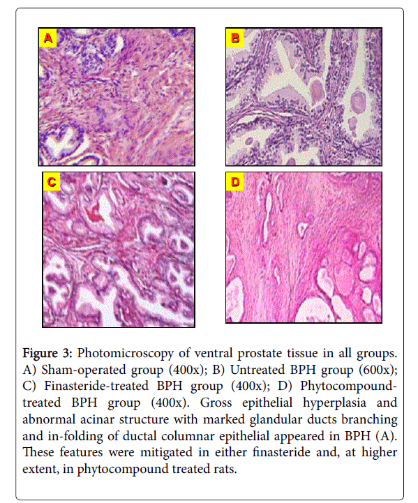 clinical-pharmacology-biopharmaceutics-ventral-prostate