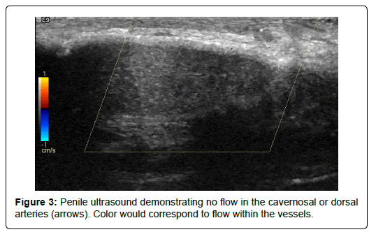 clinical-research-foot-Penile-ultrasound