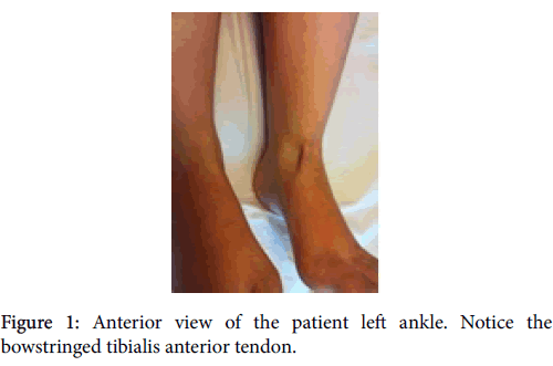 clinical-research-foot-ankle-Anterior-view-patient-left-ankle