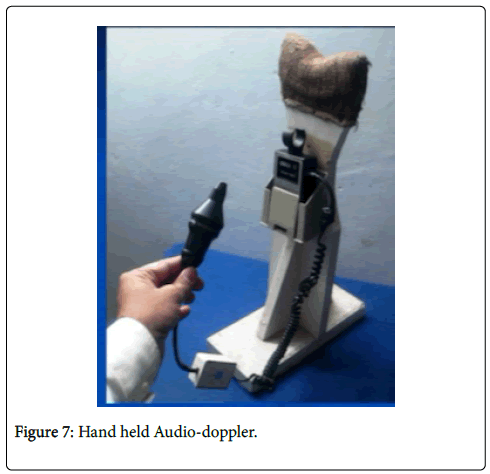 clinical-research-foot-ankle-Audio-doppler