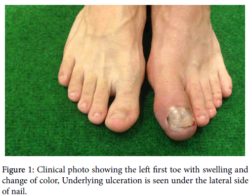 clinical-research-foot-ankle-Clinical-photo-showing