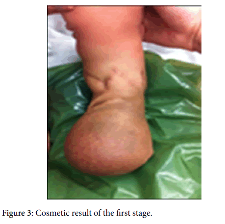 clinical-research-foot-ankle-Cosmetic-result