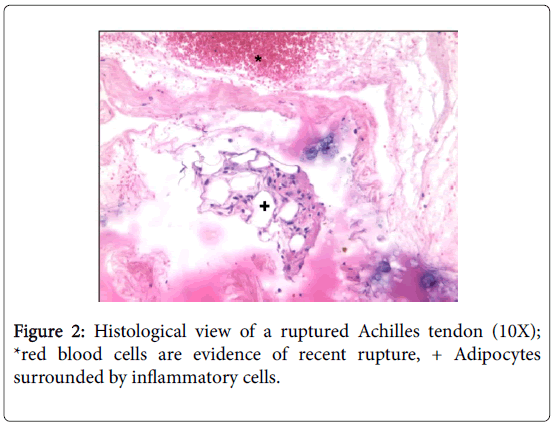 clinical-research-foot-ankle-Histological-view