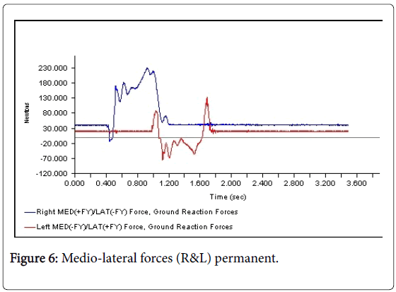clinical-research-foot-ankle-Medio-lateral-forces