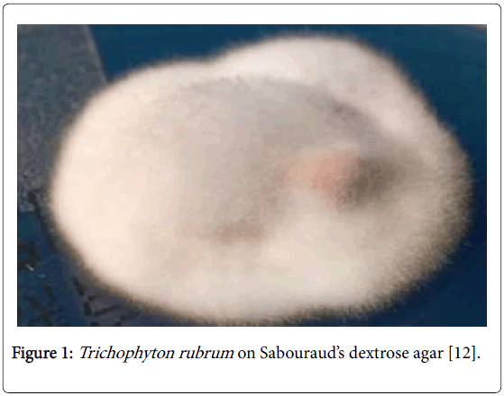 clinical-research-foot-ankle-Trichophyton-rubrum