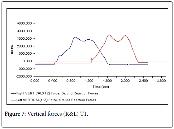 clinical-research-foot-ankle-Vertical-forces