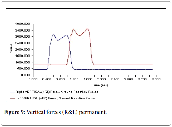 clinical-research-foot-ankle-Vertical-forces-permanent