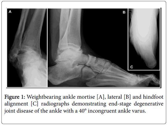 clinical-research-foot-ankle-Weightbearing-ankle