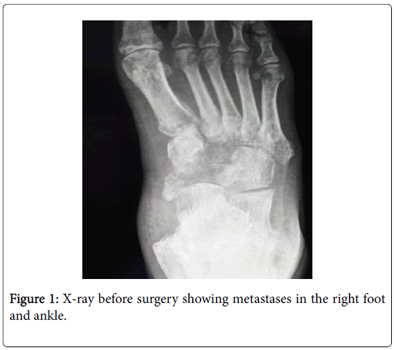 clinical-research-foot-ankle-X-ray
