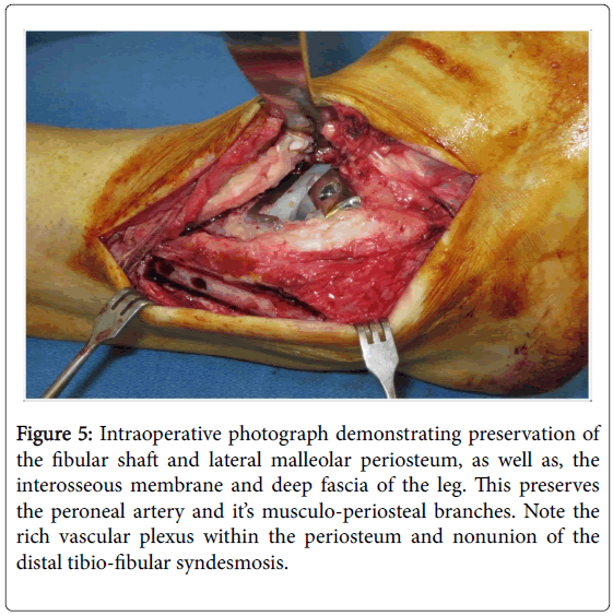 clinical-research-foot-ankle-demonstrating-preservation