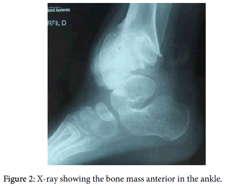 clinical-research-foot-ankle-mass-anterior-ankle
