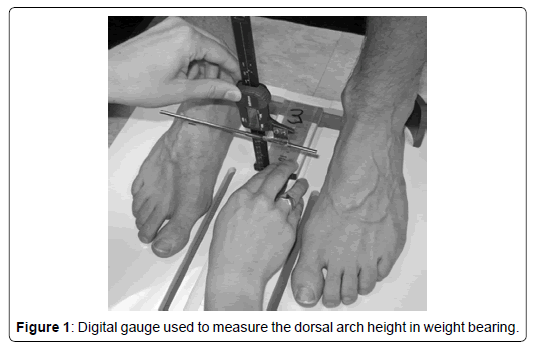 clinical-research-foot-dorsal-arch-height