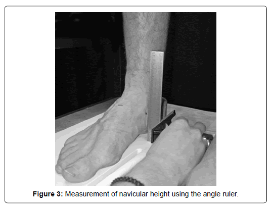 clinical-research-foot-navicular-height