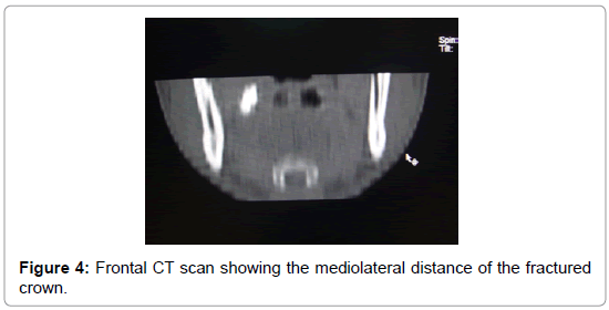 community-medicine-CT-scan