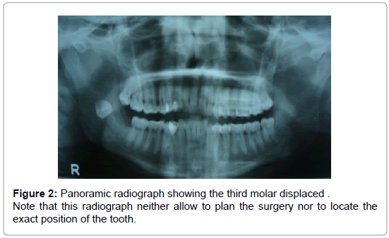 community-medicine-Panoramic-radiograph
