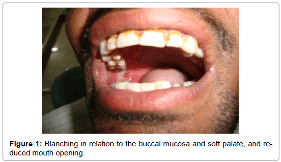 community-medicine-buccal-mucosa