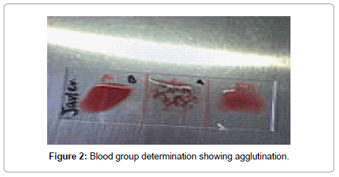 community-medicine-health-education-agglutination