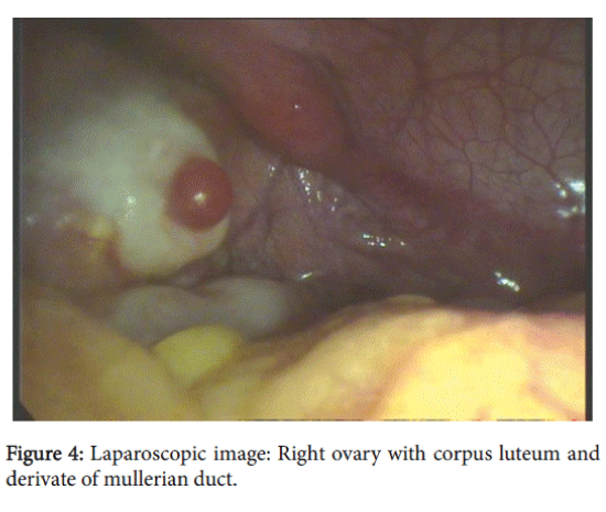 community-medicine-health-education-corpus-luteum