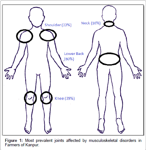 community-medicine-health-education-prevalent-joints