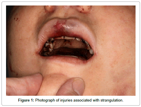 community-medicine-injuries-associated