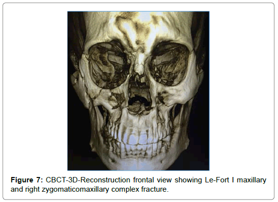cosmetology-orofacial-surgery-CBCT-3D-Reconstruction